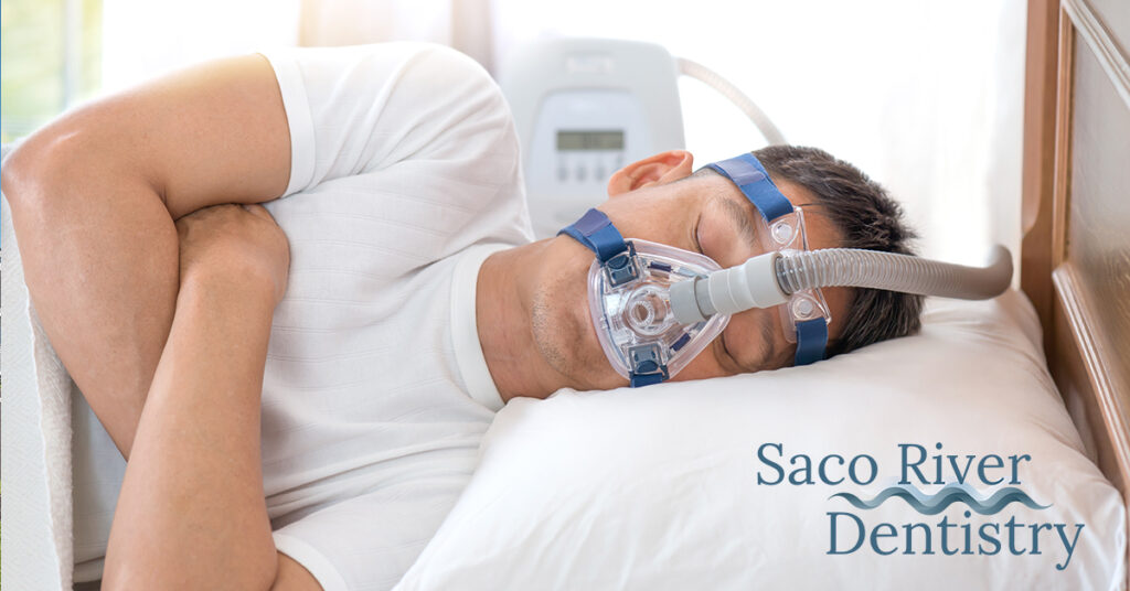 Do Mandibular Advancement Devices (MADs) Work For Sleep Apnea?